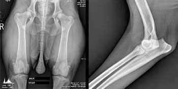 hip and elbow x-ray